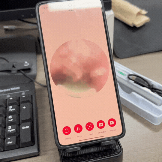 Kit de Îndepărtare Ceară de Urechi fără Fir cu 7 Piese, Cameră și Lumină, 6 Vârfuri, pentru iOS și Android